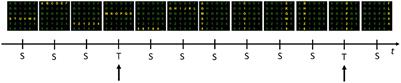 Merging Brain-Computer Interface P300 speller datasets: Perspectives and pitfalls